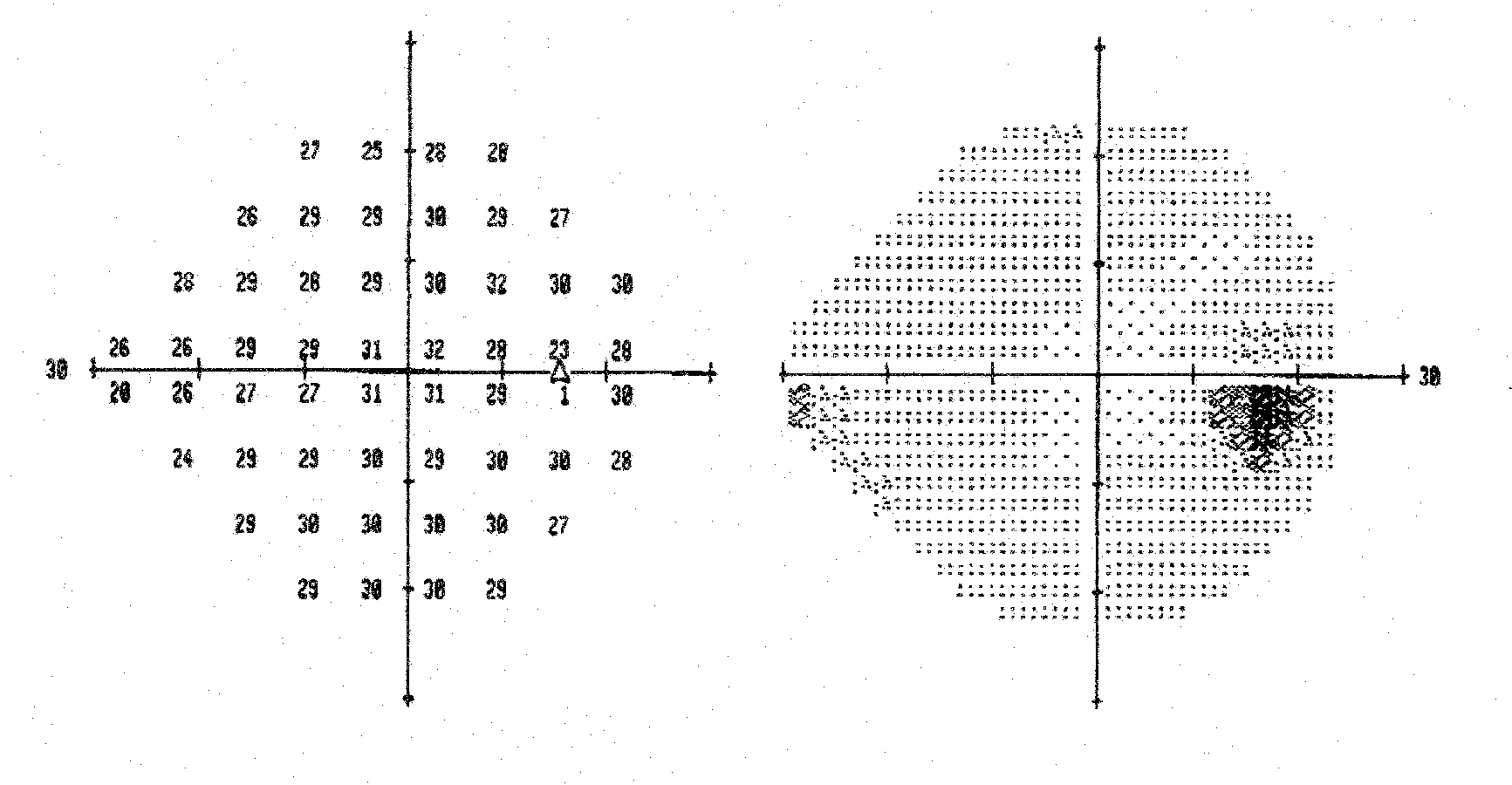 visual field OD